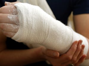 Injured Arm